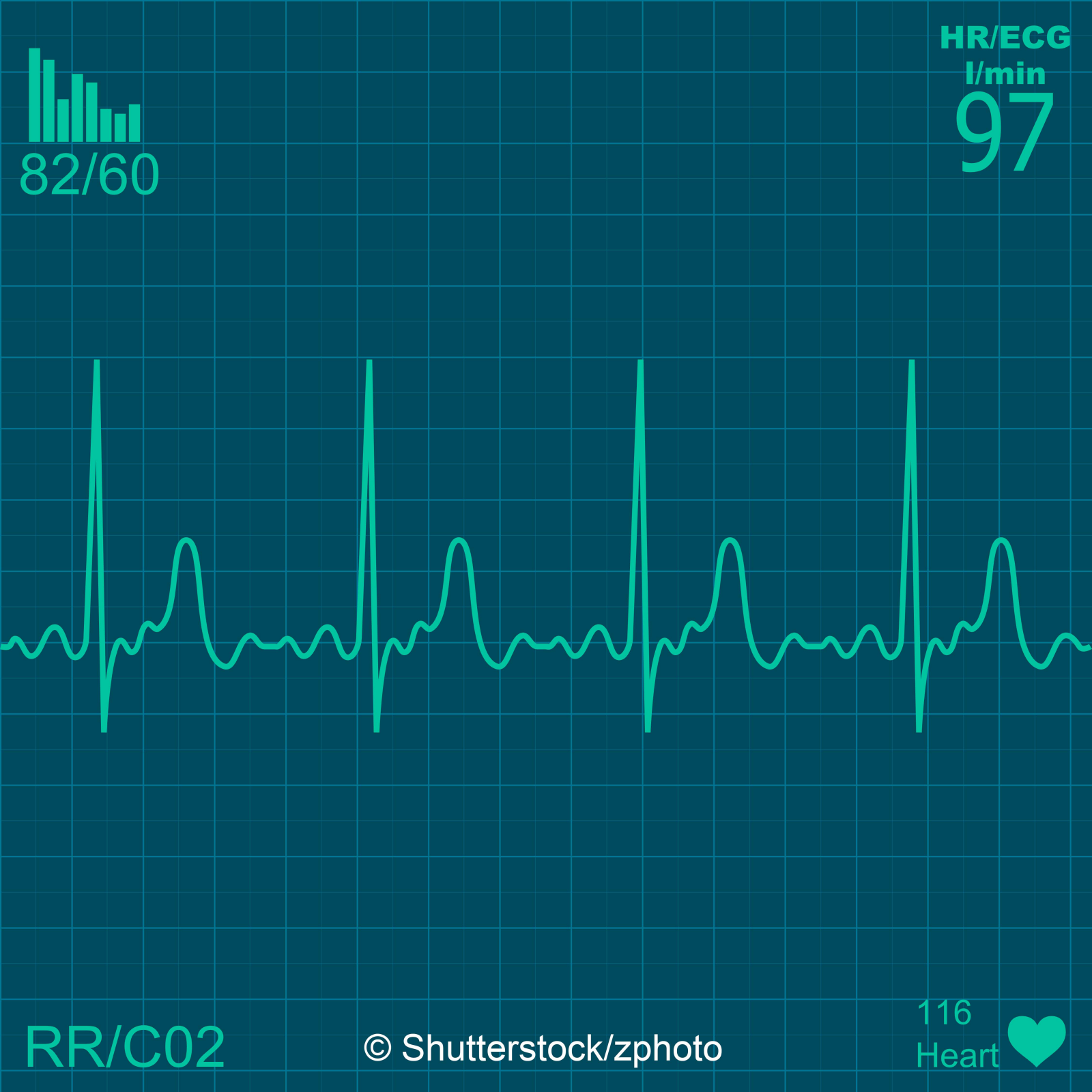 60000316 Illustration of electrical activity of the human heart