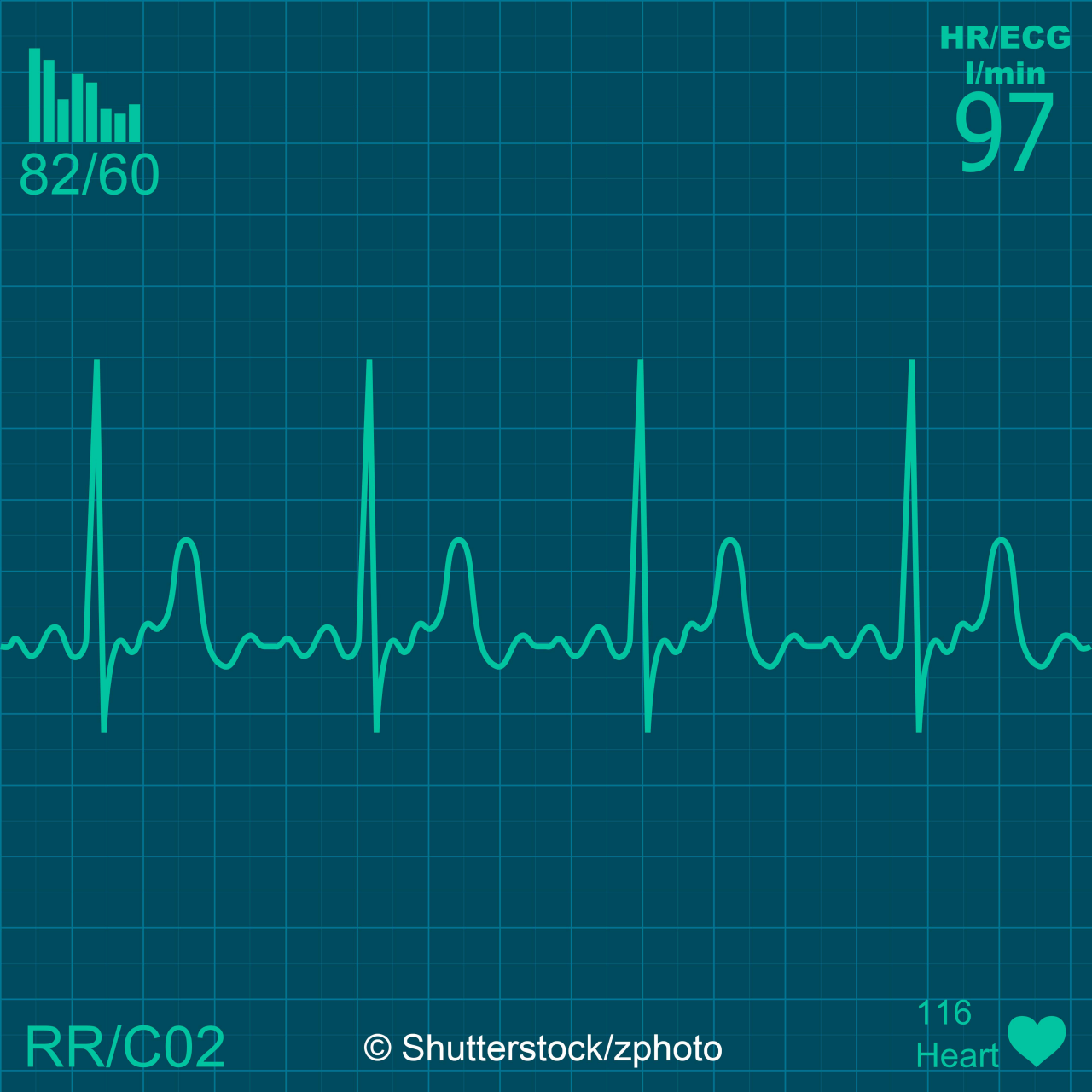 Illustration of electrical activity of the human heart